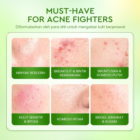 ACNAWAY Mugwort Gel Mask 3