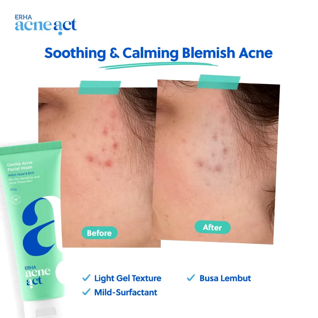 ERHA Clinic Indonesia AcneAct Gentle Acne Facial Wash 