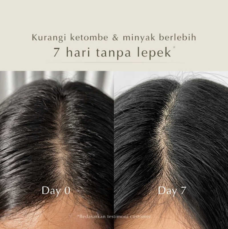 Beamarry Rosemary Tea Tree Energy Shampoo 4