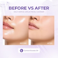 ELFormula Daily Gentle Low pH Facial Cleanser 5