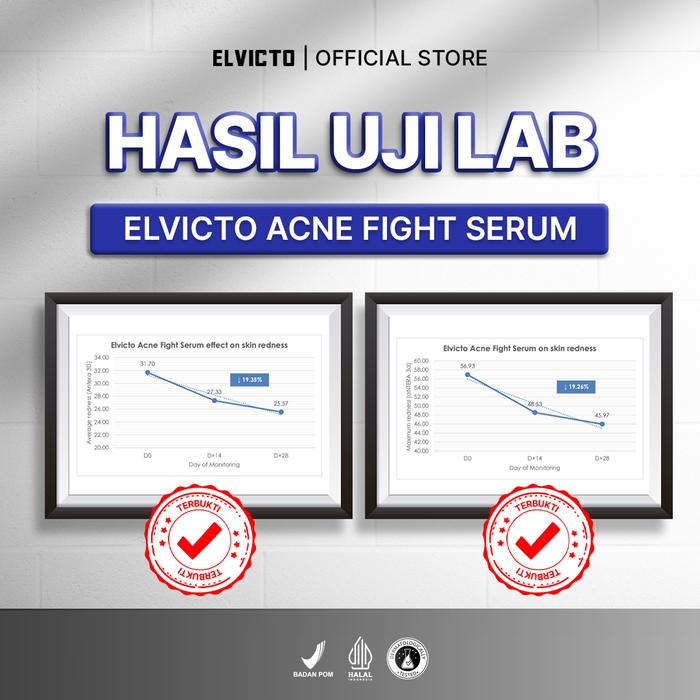 Gizi Indonesia ELVICTO Acne Fight Serum