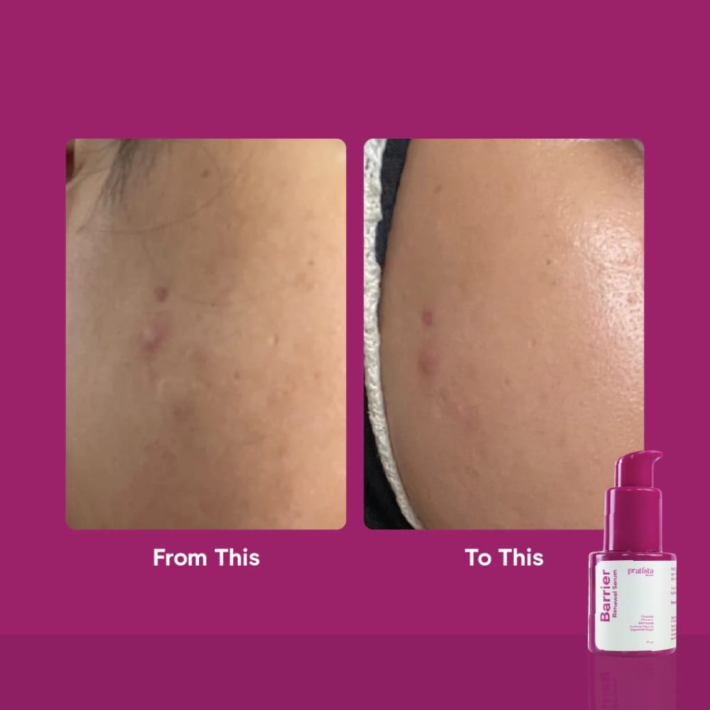 Pratista Citra Nusantara Pratista Barrier Renewal Serum