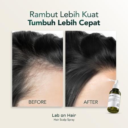 Good Sale Tech Lab On Hair Hair Scalp Spray