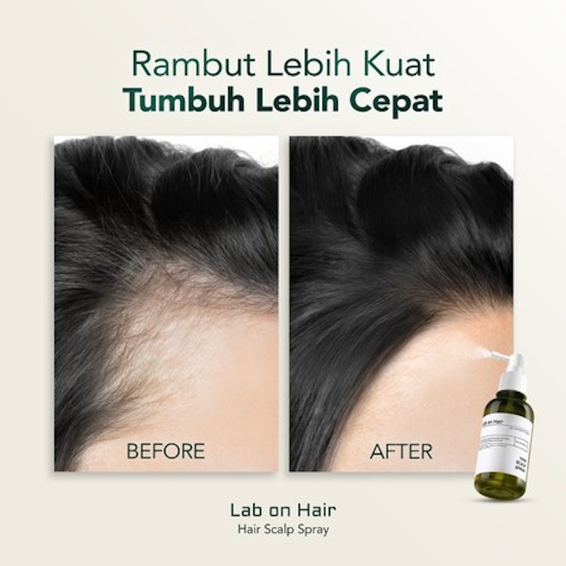 Lab On Hair Hair Scalp Spray 4