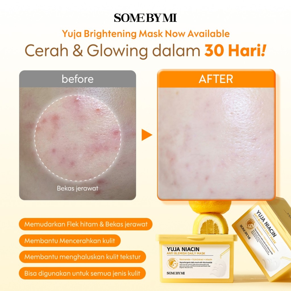 Perennebell SOME BY MI Yuja Niacin Anti-Blemish Daily Mask