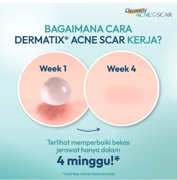 Menarini Asia-pacific Holdings Dermatix Acne Spot Care