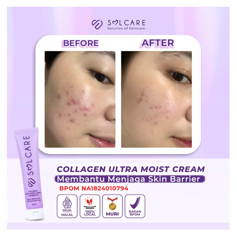 STC Sarana Estetika Solcare Collagen Ultra Moist Cream + Probiotic