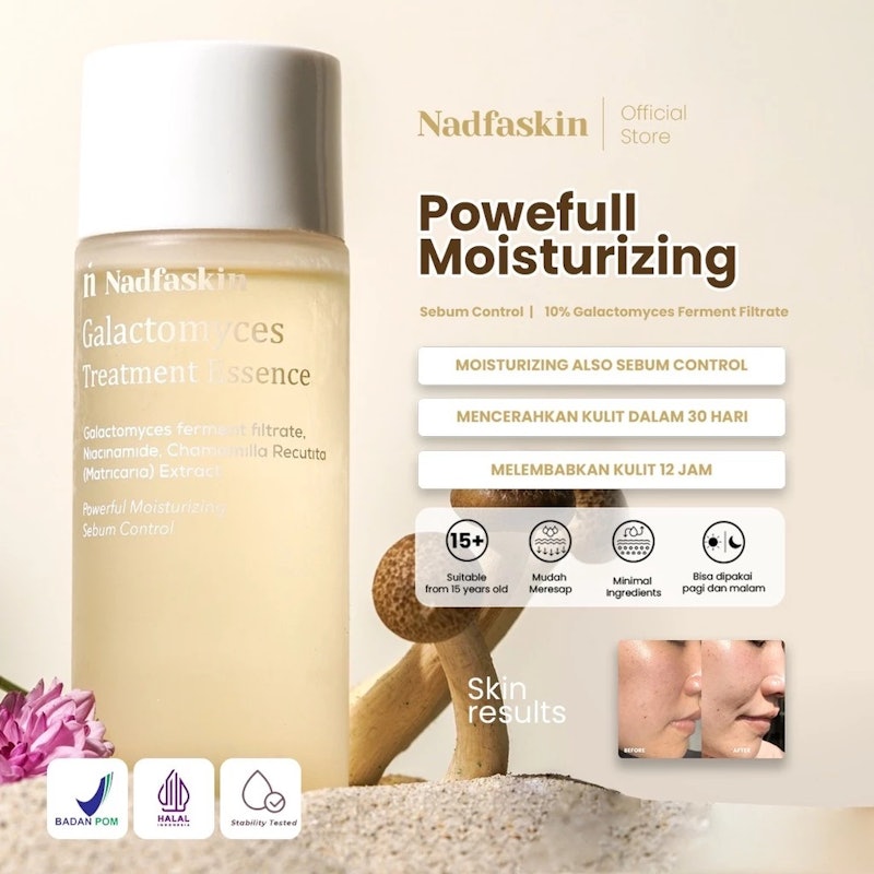 Nadfaskin Galactomyces Treatment Essence 5