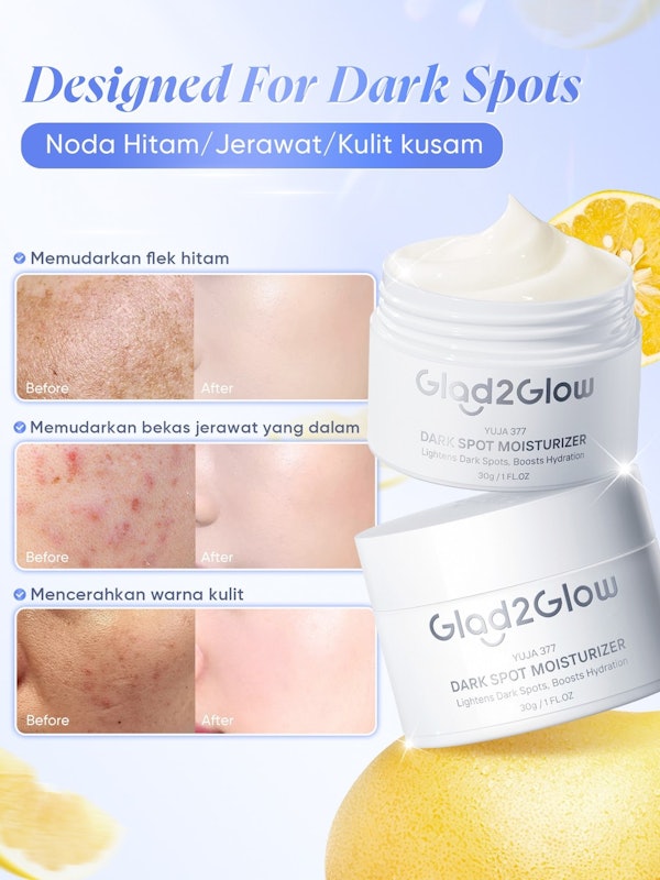 Glad2Glow Yuja Symwhite 377 Dark Spot Moisturizer 4