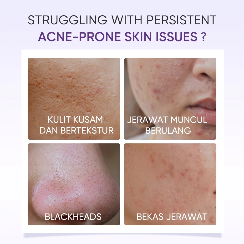 SKINTIFIC Cosmetics SKINTIFIC Lactic Acid Skin Renewal Exfoliating Serum