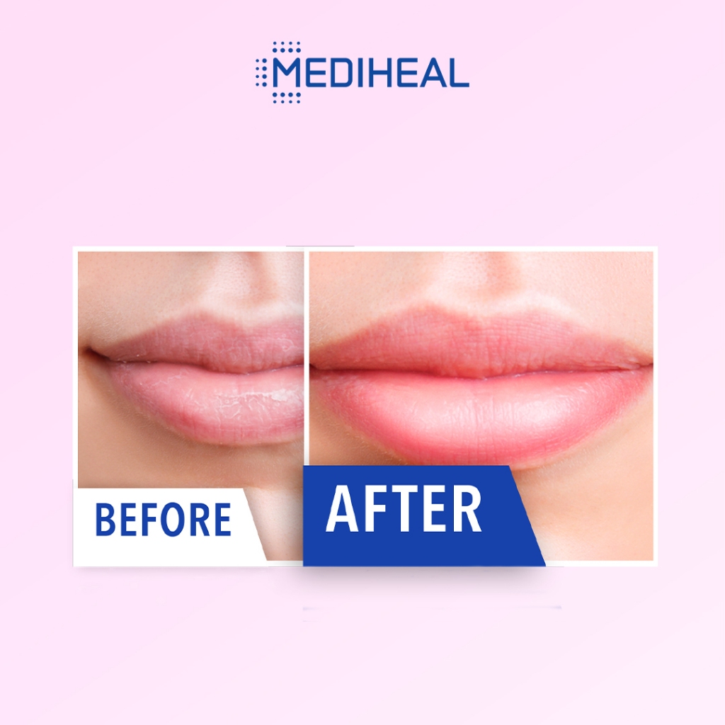 L&P Cosmetic Mediheal Pantenolips Sleeping Mask