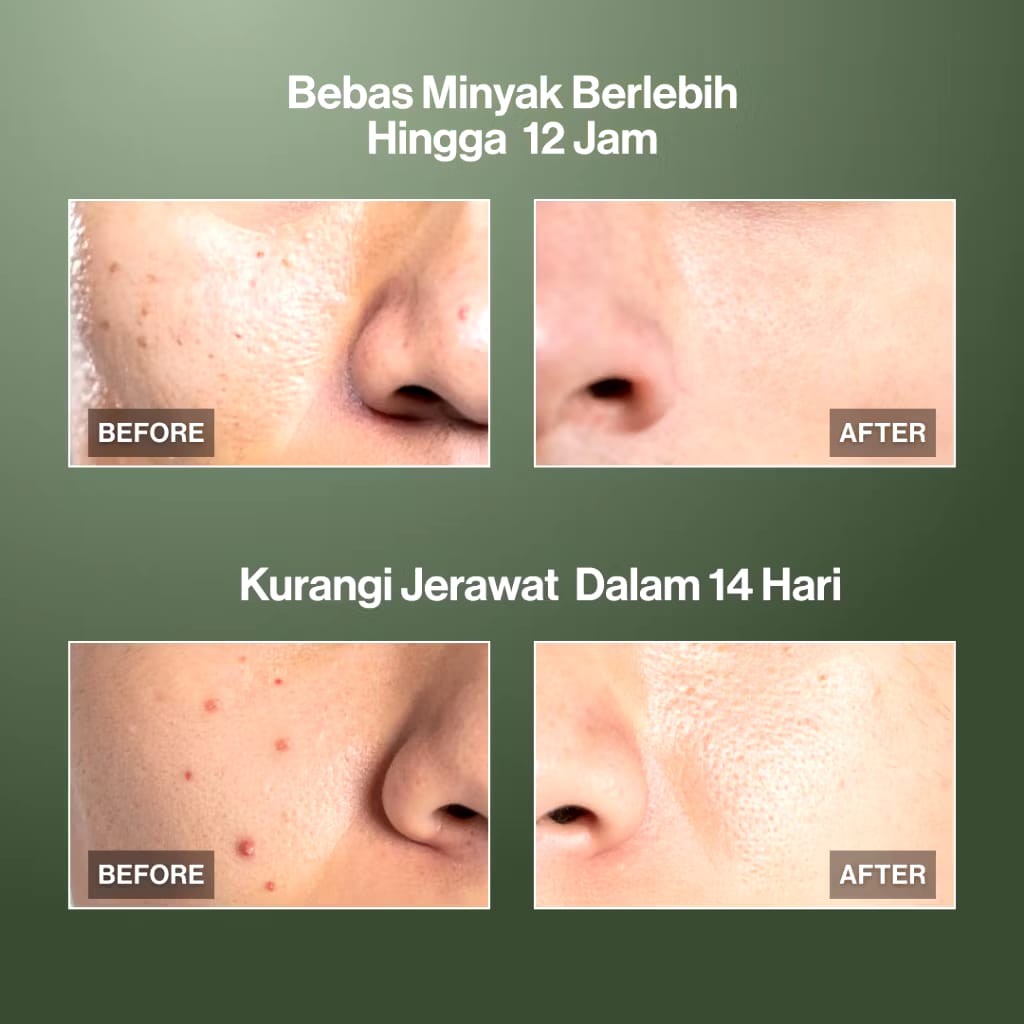 Paragon Technology and Innovation  Kahf Oil and Acne Care Face Wash