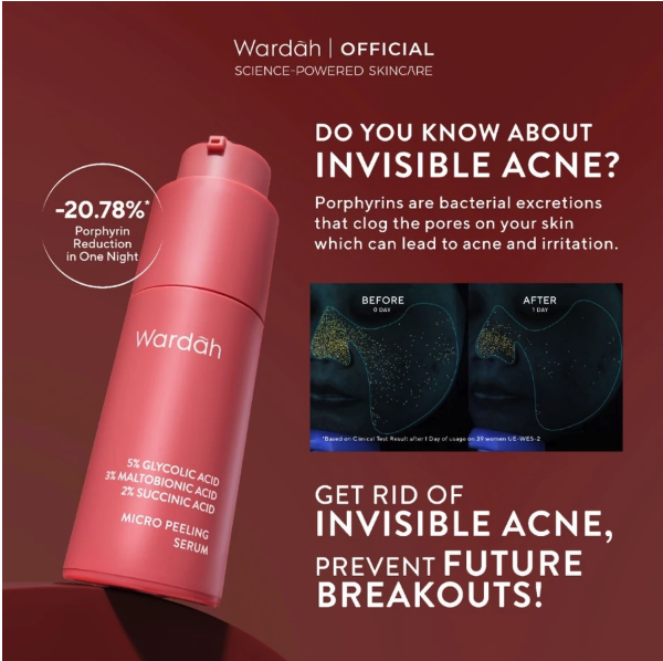 Paragon Technology and Innovation Wardah 5% Glycolic Acid 3% Maltobionic Acid 2% Succinic Acid Micro Peeling Serum