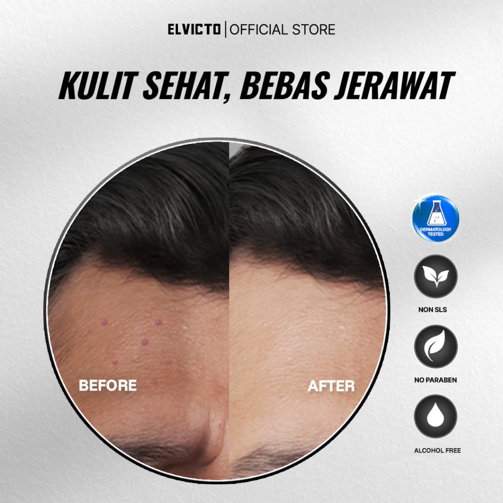 Gizi Indonesia ELVICTO Acne Fight Serum