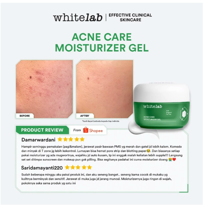 Natura Deca Kosmetika Whitelab  Acne Care Moisturizer Gel