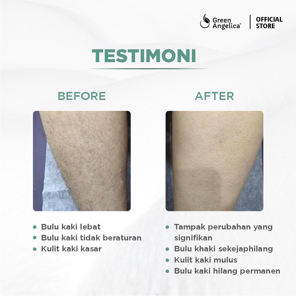 Green Angelica Hair Removal Liquid
