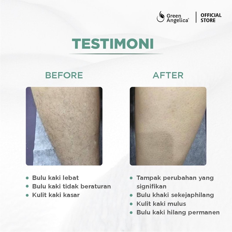 Green Angelica Hair Removal Liquid 4