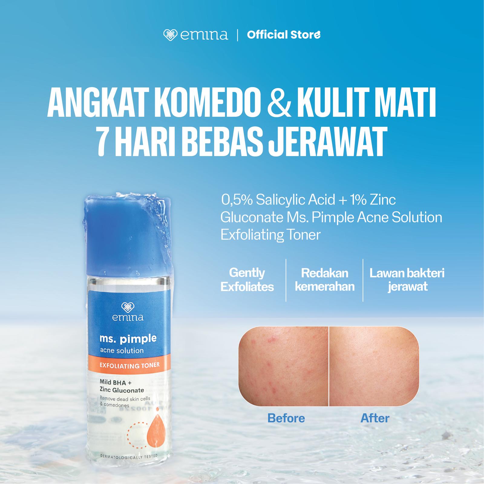 Ms. Pimple Acne Solution Exfoliating Toner 2
