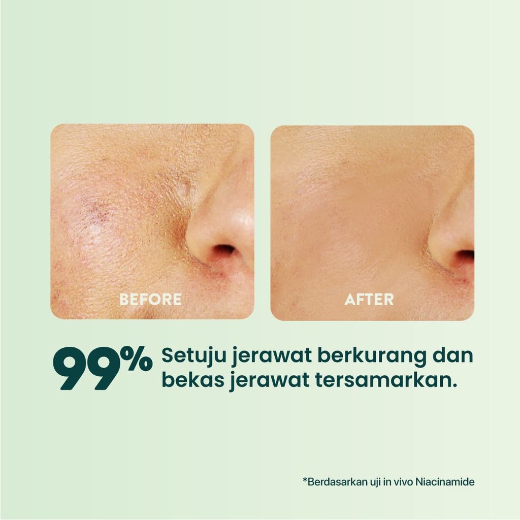 NPURE Cica Face Sheet Mask 4