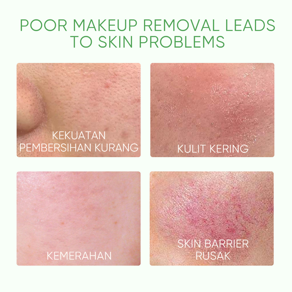 SKINTIFIC Cosmetics SKINTIFIC Mugwort Purifying Micellar Water