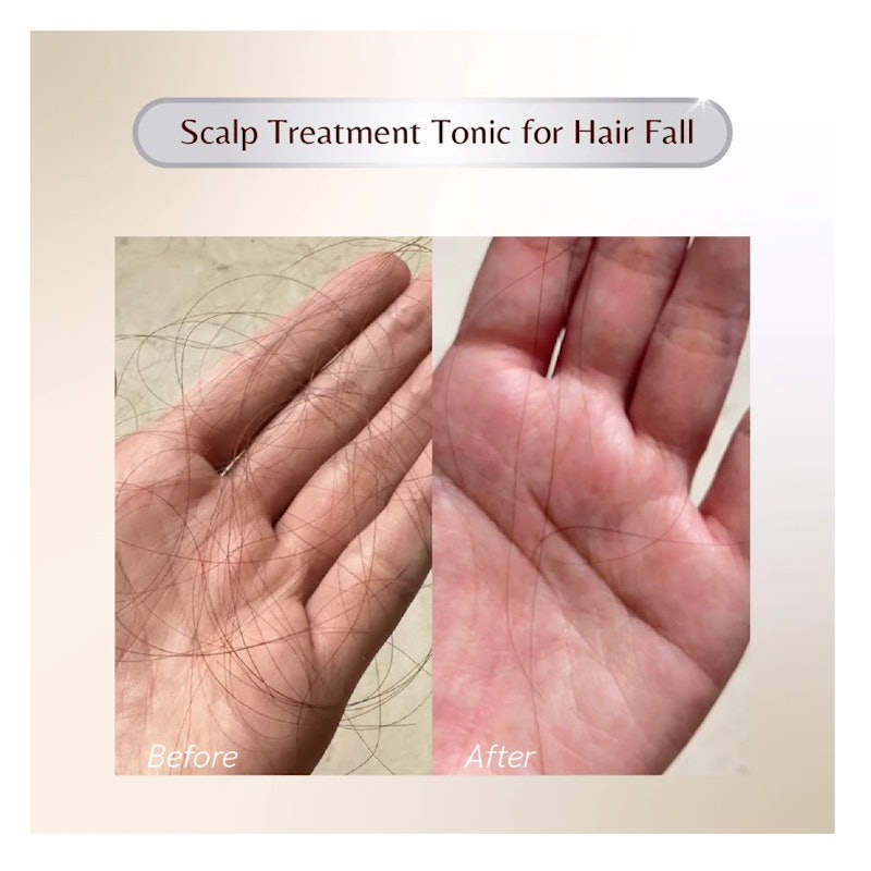 Everlaskin Scalp Treatment Hair Tonic 5