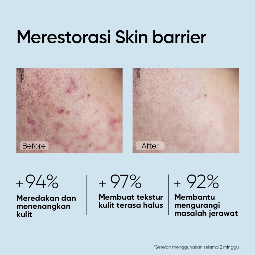 Skintific Cosmetics SKINTIFIC 5X Ceramide Barrier Repair Serum