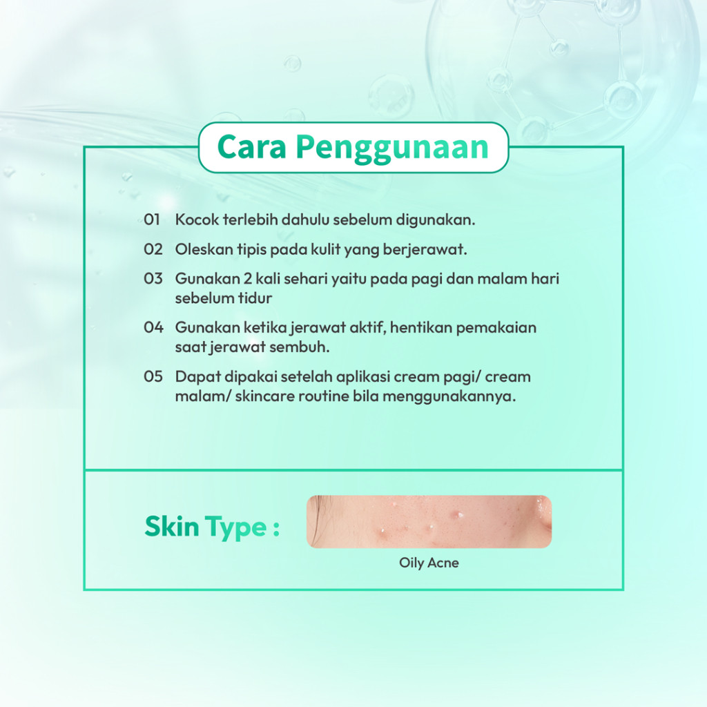 Larissa Acne Lotion