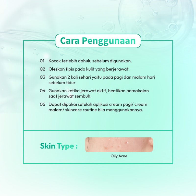 Larissa Acne Lotion 4