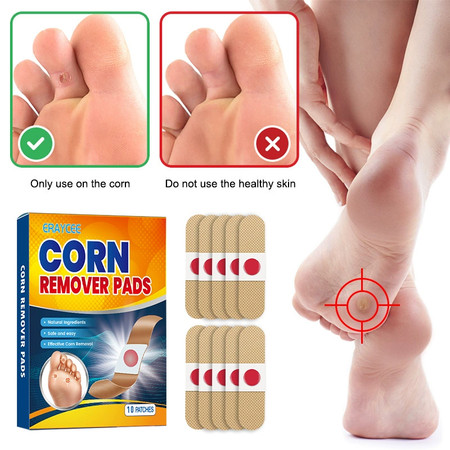 Eraycee Corn Removal Pads