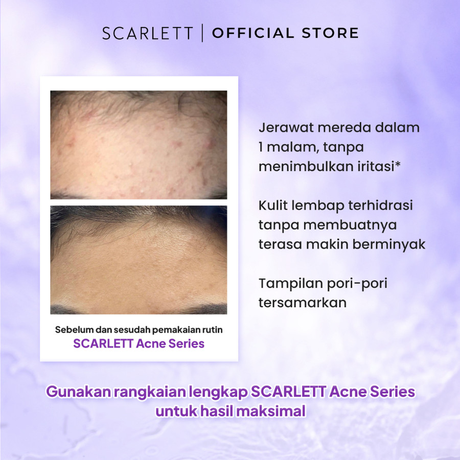 Opto Lingkar Sejahtera Scarlett Whitening Acne Cream Night