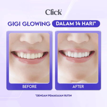 Kino Indonesia Click Natural Toothpaste Whitening + Cavity Protection