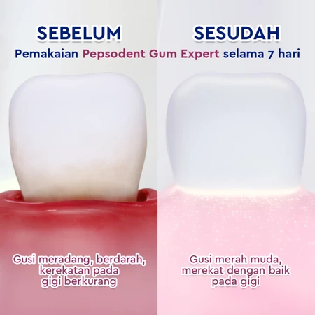 Unilever Indonesia Pepsodent Gum Expert Whitening
