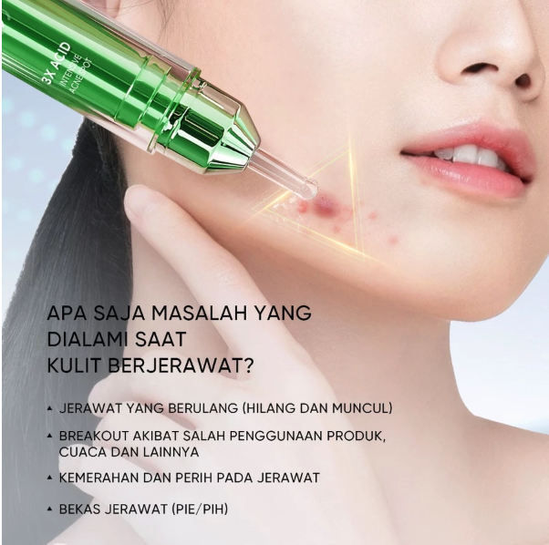 SKINTIFIC Cosmetics SKINTIFIC 3X Acid Intensive Acne Spot Gel 