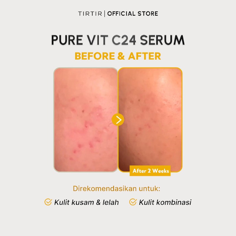 TIRTIR Pure Vitamin C24 Serum 4