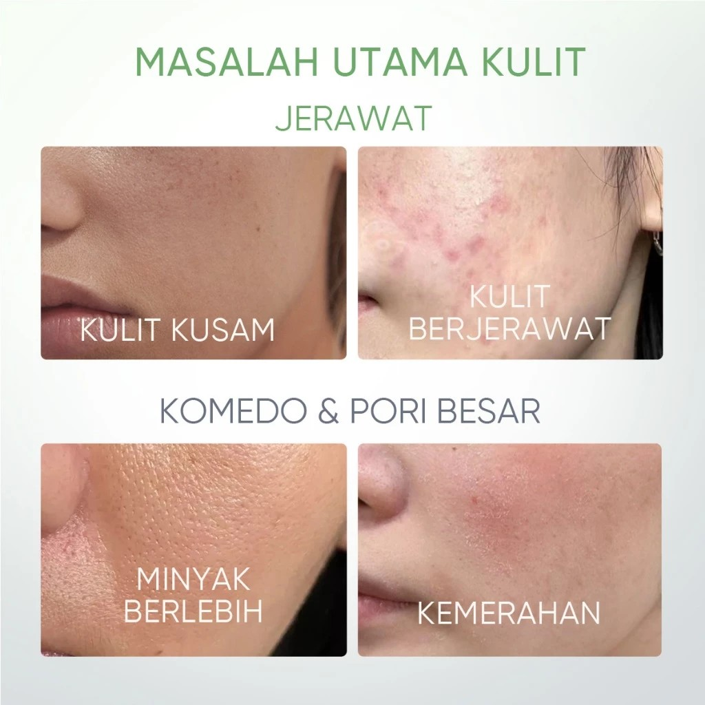 SKINTIFIC Cosmetics SKINTIFIC Mugwort Acne Clay Stick 