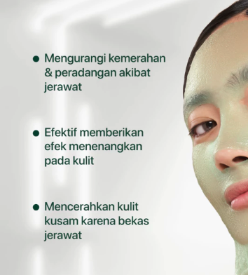 Penta Natural Kosmetindo N'PURE Cica Acne Care Complex Treatment Face Essence Sheet Mask