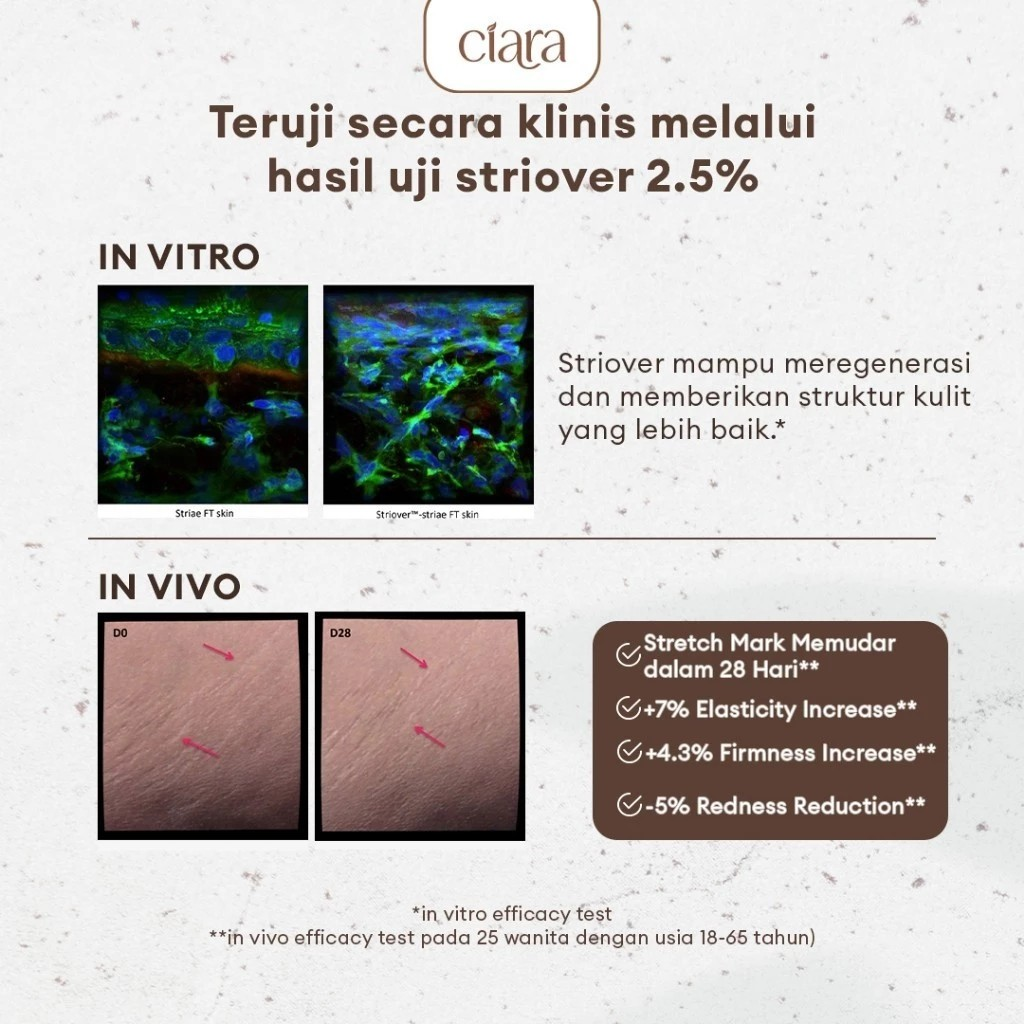 Ciara Indonesia Ciara Stretch Mark Treatment