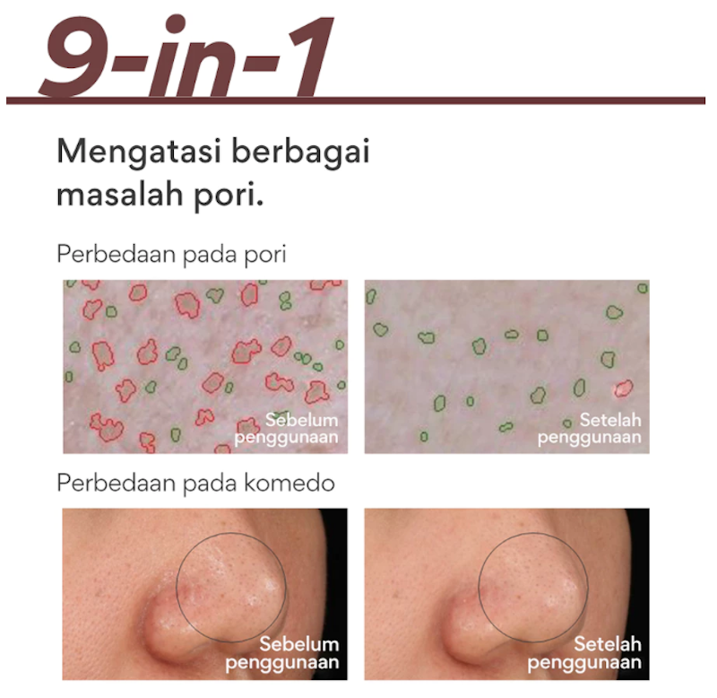 Super Volcanic Pore Clay Mask 4