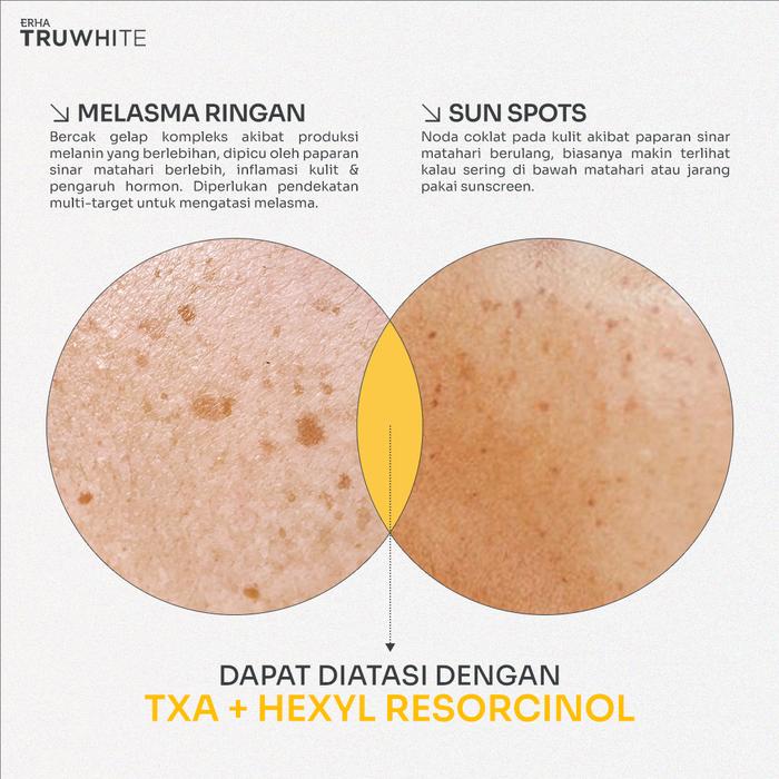 ERHA Clinic Indonesia Truwhite Active Glow Booster Series with 3% TXA & Hexyl Resorcinol