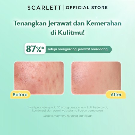 Opto Lingkar Sejahtera Scarlett Whitening Low pH Gel Cleanser Acne Peace