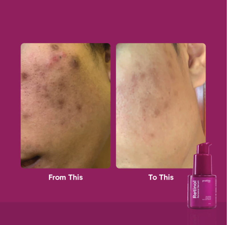 Pratista Retinol Renewal Serum 5