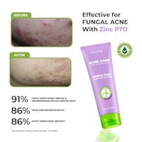 Triple Care Acne Calm Cleanser 5