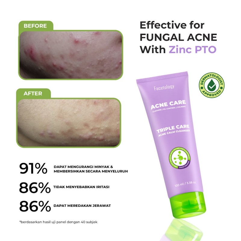 Triple Care Acne Calm Cleanser 5