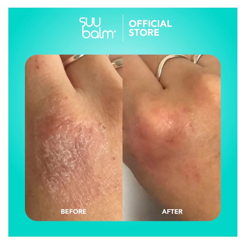 Suu Balm Ceramide Moisturiser Rapid Itch Relief 4