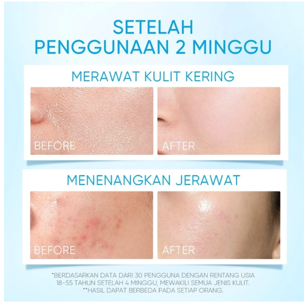 SKINTIFIC Cosmetics SKINTIFIC 5X Ceramide Barrier Moisturizer Gel