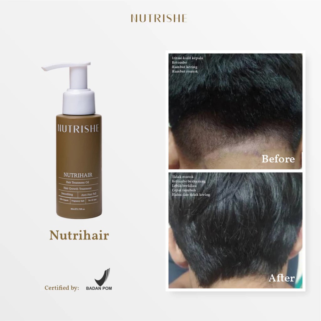 Naura Global Indonesia Nutrishe Nutrihair