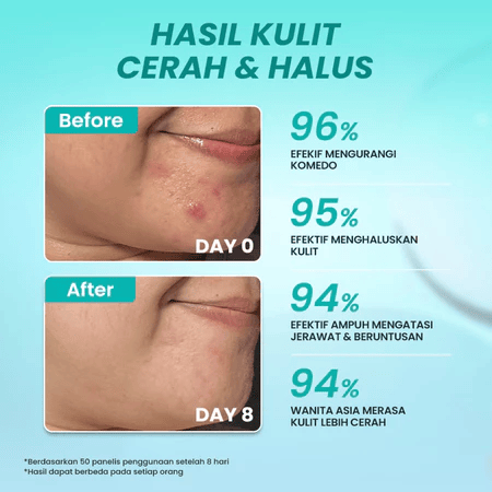 Eka Jaya Internasional Hanasui Advance Exfoliating Serum 