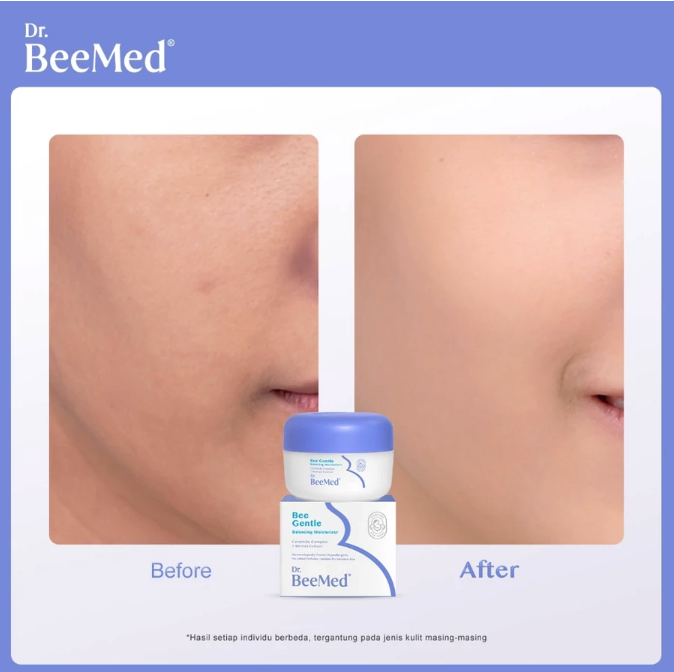 Docbee Deca Indonesia  Dr. BeeMed Bee Gentle Balancing Moisturizer