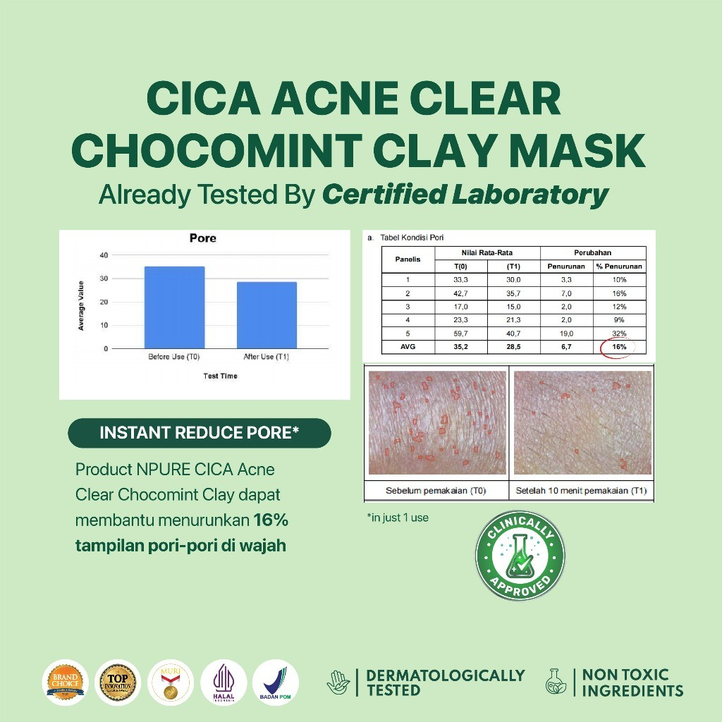 Cica Acne Clear Chocomint Clay Mask 5