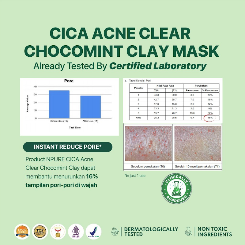 Cica Acne Clear Chocomint Clay Mask 5
